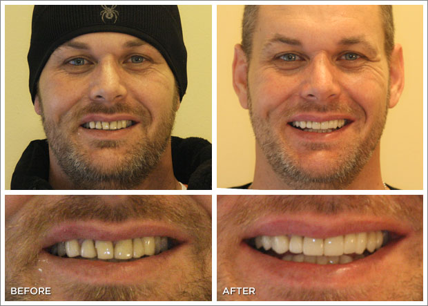 Before and After Photos | Thornton Dental Care